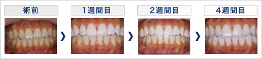 m-case1
