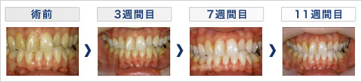 m-case2